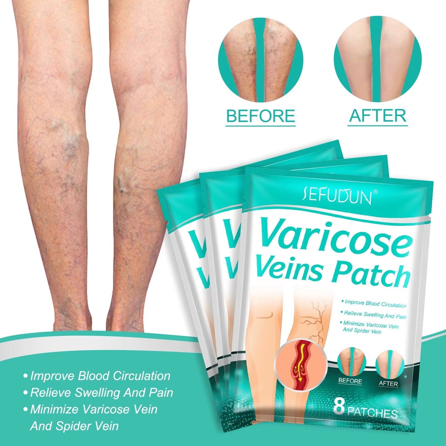 VeinEase™ Επίθεμα κιρσών