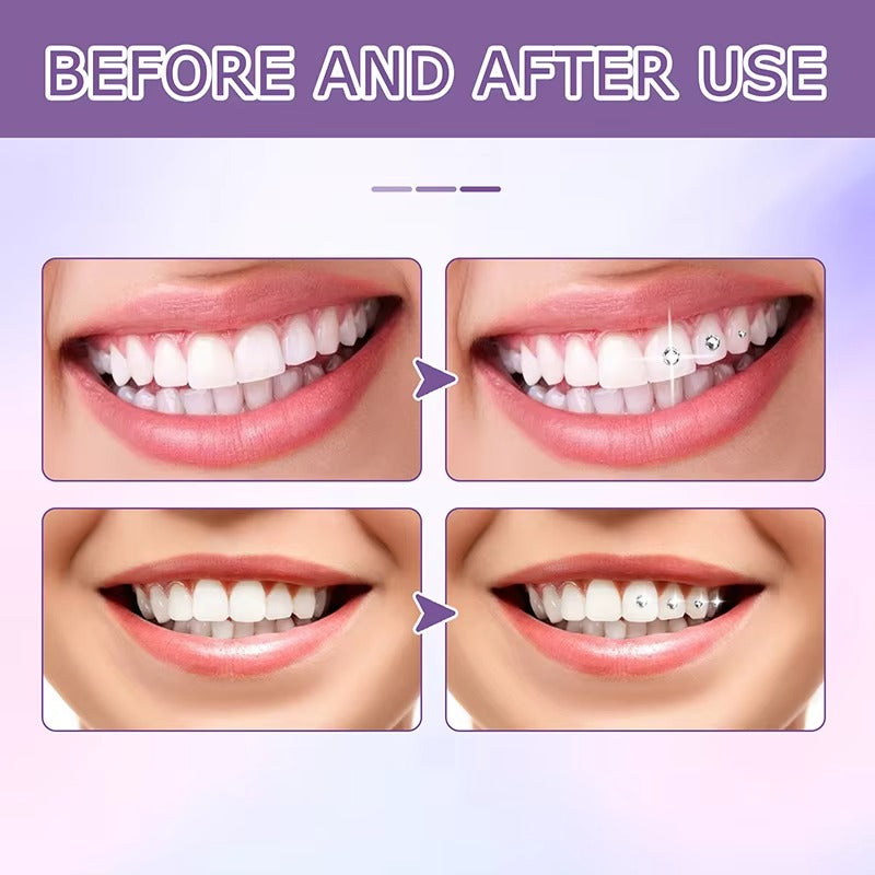 ToothGlam™ Λάμψε με Κάθε Χαμόγελο