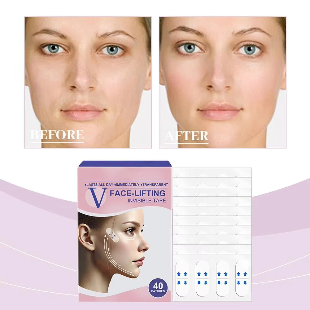 Ταινία Lifting Προσώπου Luma Lift™ V