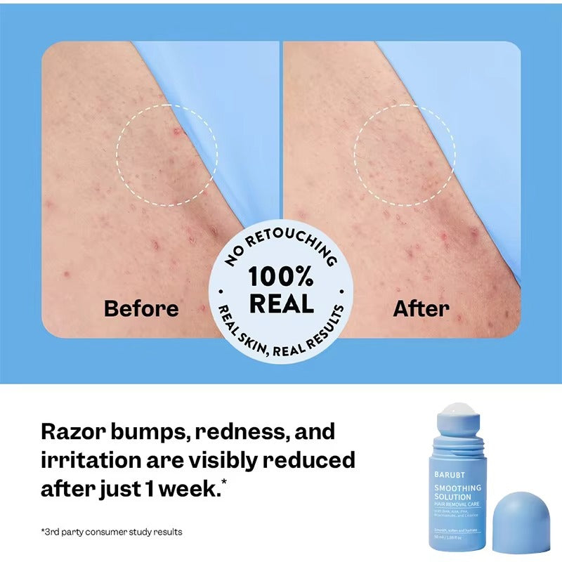 SkinCleanse™ Καταπραϋντικός Ορός για Ερεθισμούς από Ξύρισμα
