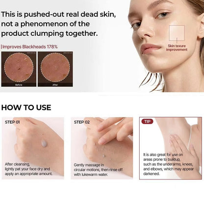 RadiGlow™ Απολεπιστικό Peel